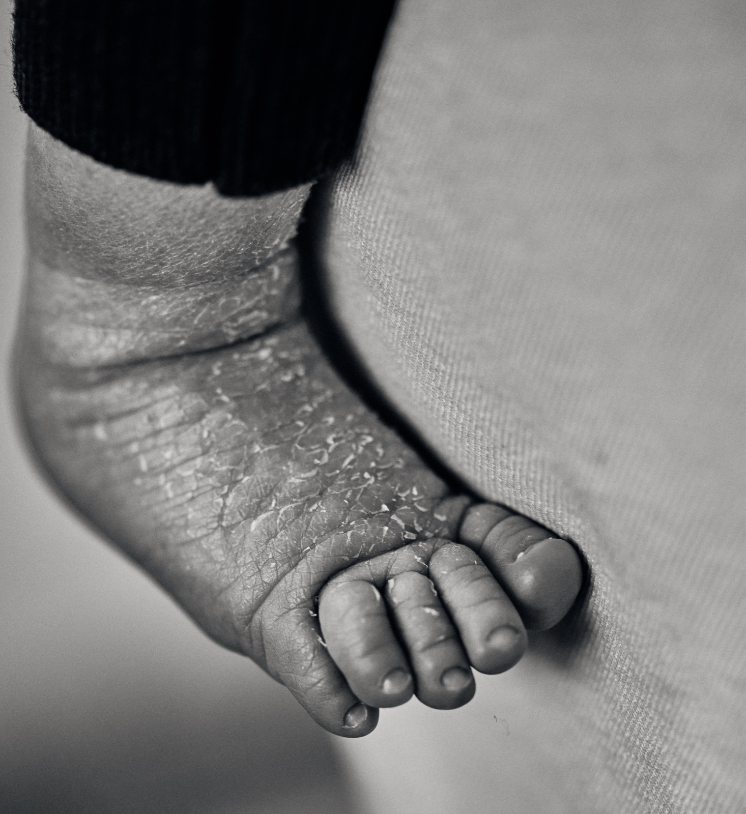 Detail of a newborn's foot with flaky newborn skin, black and white